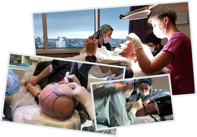 Hair Transplantation <br>with DHI Method
