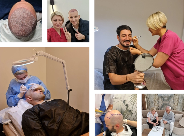 Hair Transplantation <br>in a Clinical Environment
